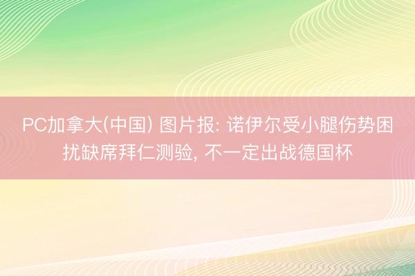 PC加拿大(中国) 图片报: 诺伊尔受小腿伤势困扰缺席拜仁测验， 不一定出战德国杯